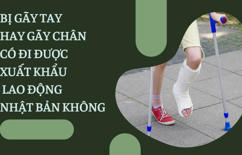BỊ GÃY TAY HAY GÃY CHÂN CÓ ĐI ĐƯỢC XUẤT KHẨU LAO ĐỘNG NHẬT BẢN KHÔNG